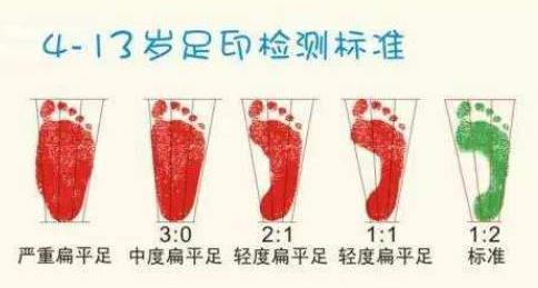 扁平足能跑步嗎？扁平足跑步有什么危害？