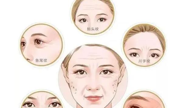 什么是假性皺紋？什么是真性皺紋